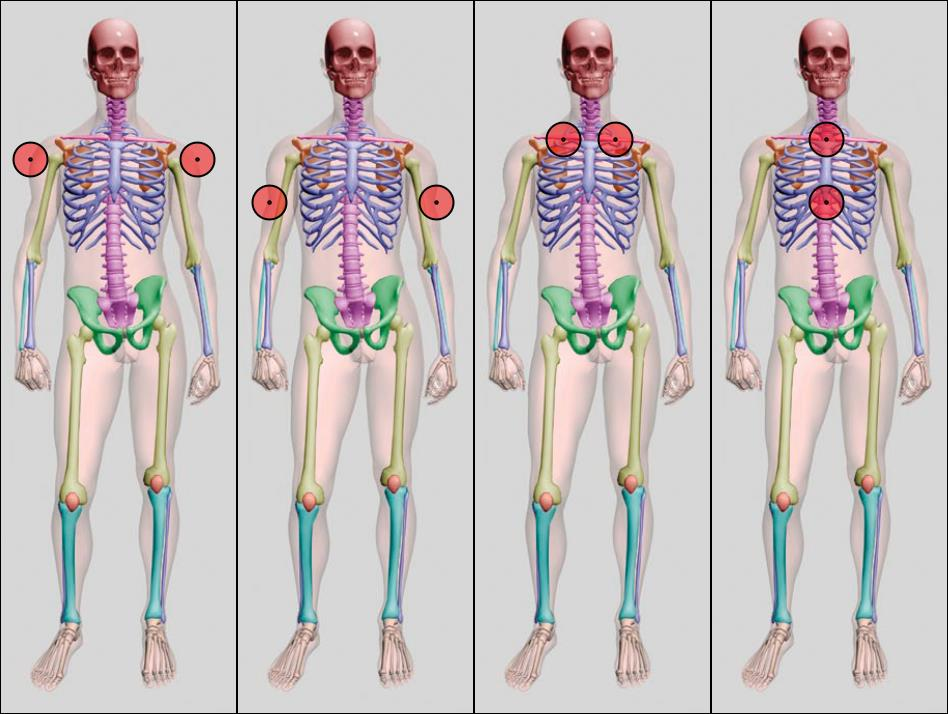 Potential Tracker placements for Mirroring Plane and Elbow IK Target. A) High Deltoid, B) 